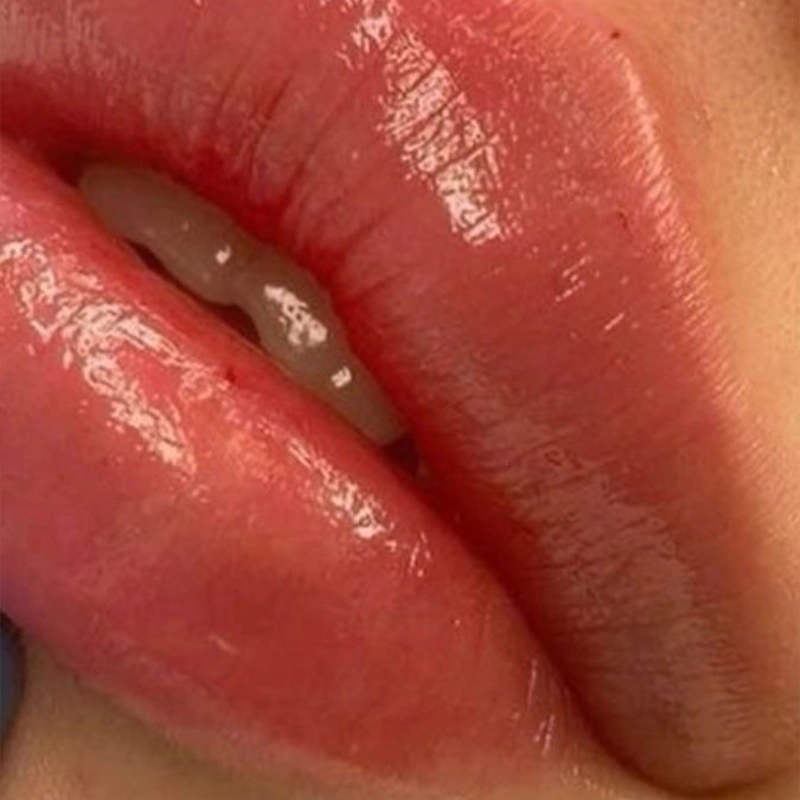 Amanda Maciag Seu sorriso merece lábios com volume